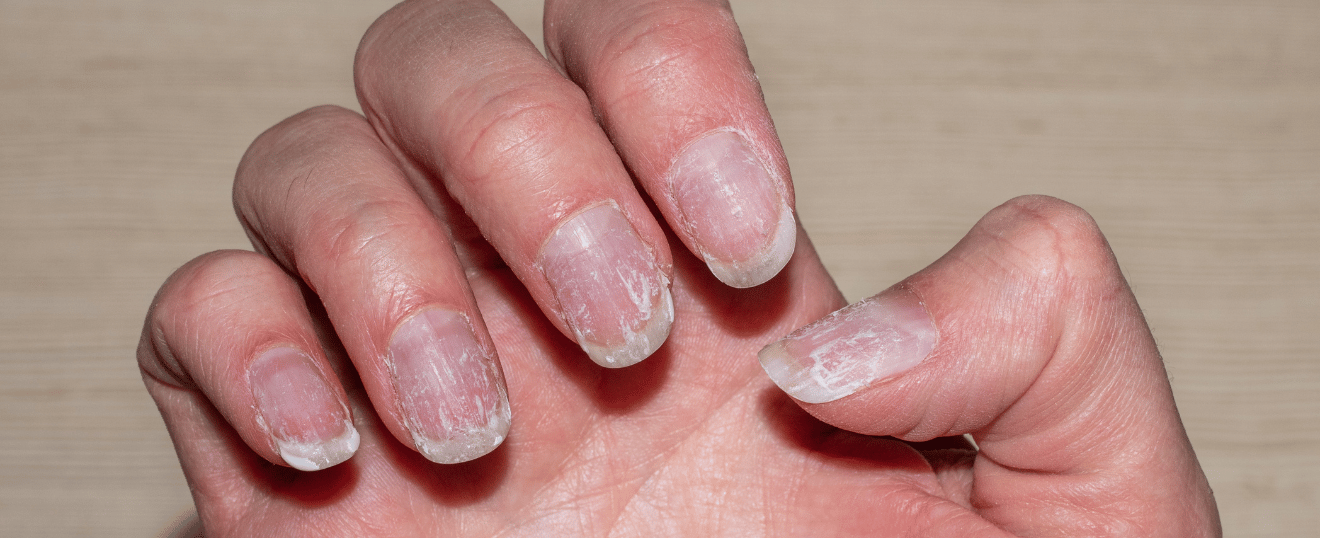 Les 6 signes que vos ongles manquent de soins (et pourquoi les ignorer les fragilise encore plus)